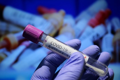 Граничен здравен контрол за гражданите, освободени от изискването за представяне на PCR тест, ще осъществява през 19 гранични пункта 